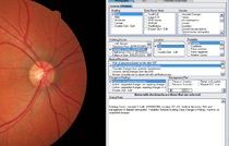 EMR Optometry Software EMR Optometry Software