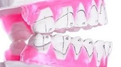 realizzazione protesi dentarie, protesi per studi dentistici, protesi mobili realizzazione protesi dentarie, protesi per studi dentistici, protesi mobili