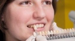 realizzazione denti, odontotecnici, protesi realizzazione denti, odontotecnici, protesi