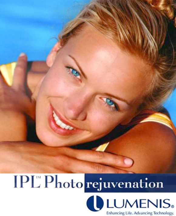trattamento IPL