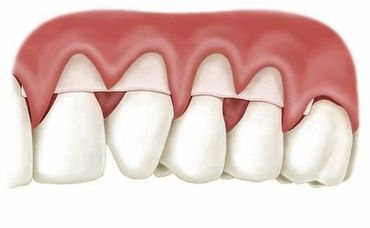 best gum graft dentists near me