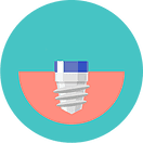 Dental implant, bone graft, tooth replacement, near me