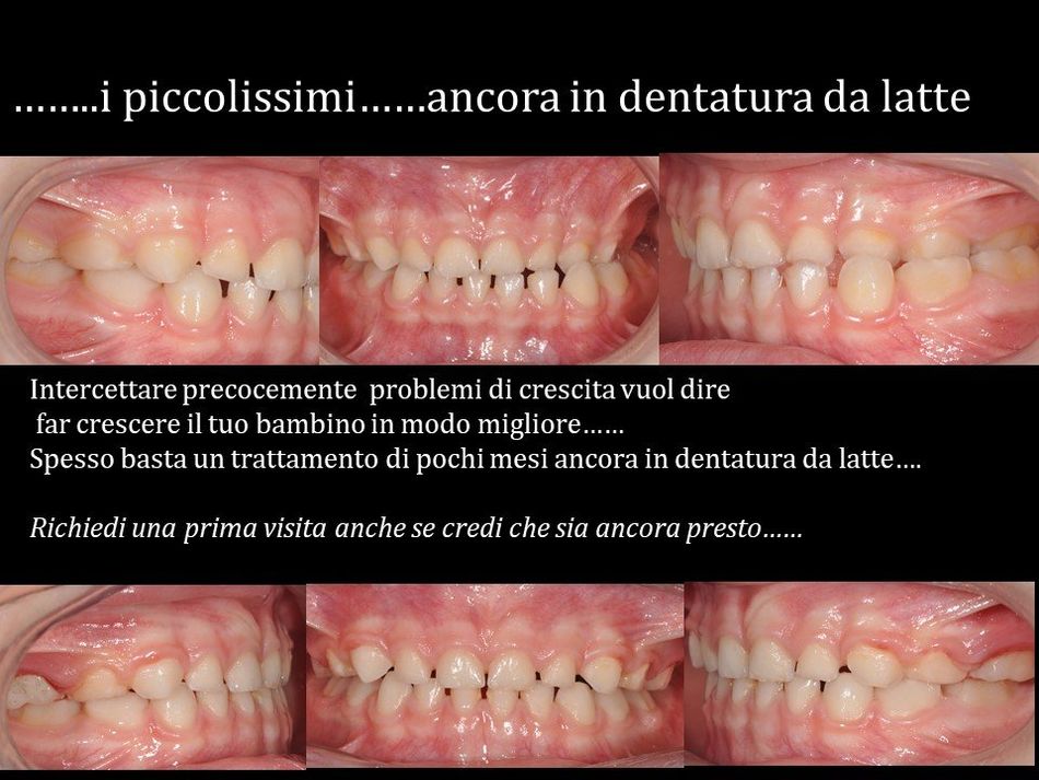 denti curati