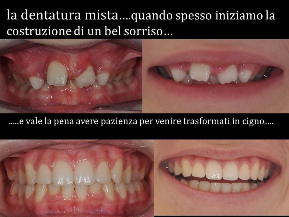 paragone denti curati