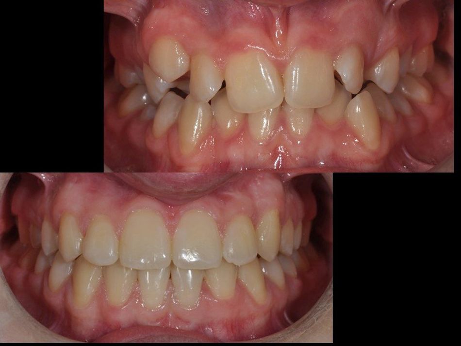 denti curati