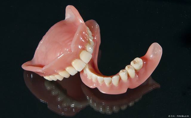 In vielen Fällen können an Stelle von Totalprothesen feste Zähne mit Implantaten gemacht werden. In vielen Fällen können an Stelle von Totalprothesen feste Zähne mit Implantaten gemacht werden.