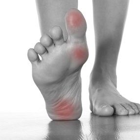 Corn and callus removal