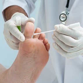 Verrucae treatment