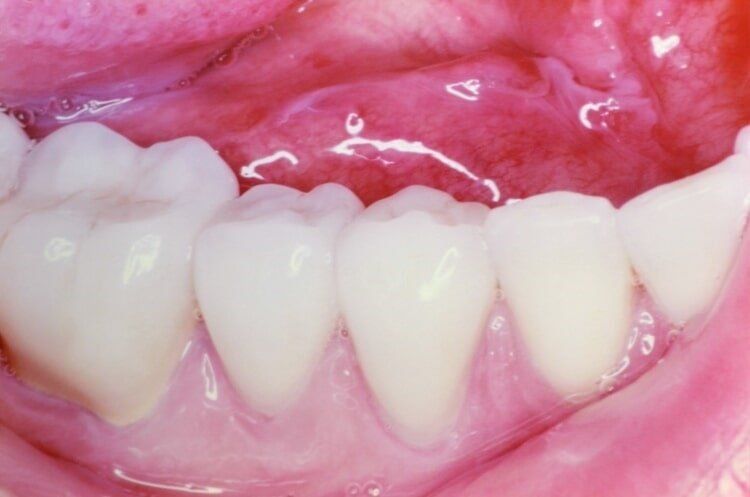 After Dental Service — Dentist Port Orange in South Daytona, FL