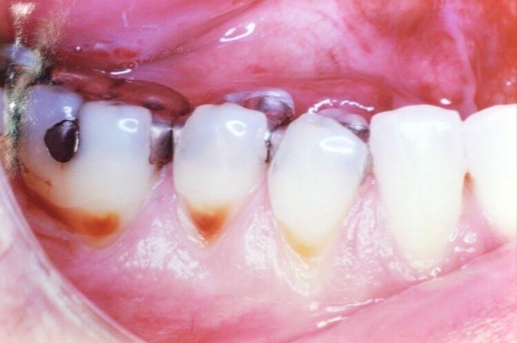 Before Dental Service — Dentist Port Orange in South Daytona, FL
