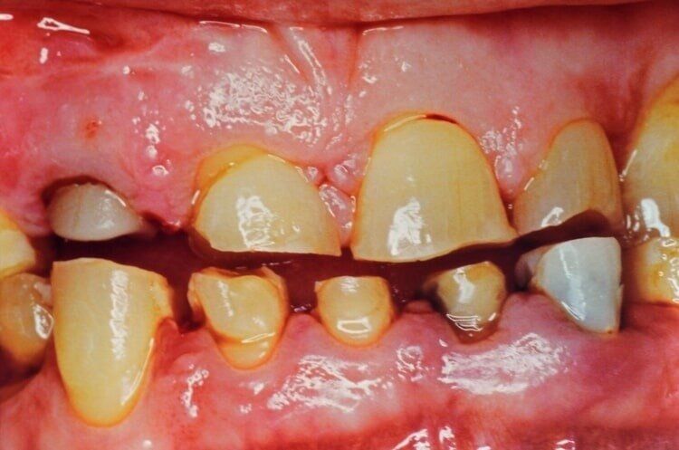 Before Cosmetic Dentistry — Dentist Port Orange in South Daytona, FL