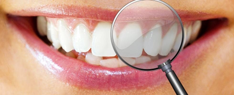 denti sani