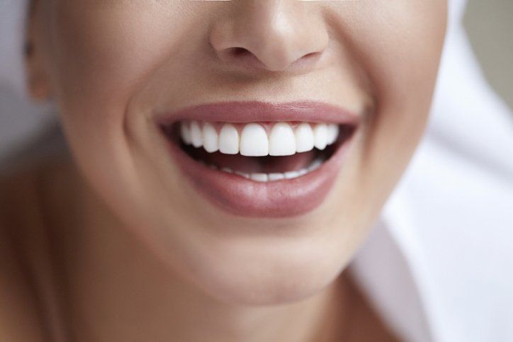 Dental Veneers in Greensboro, NC