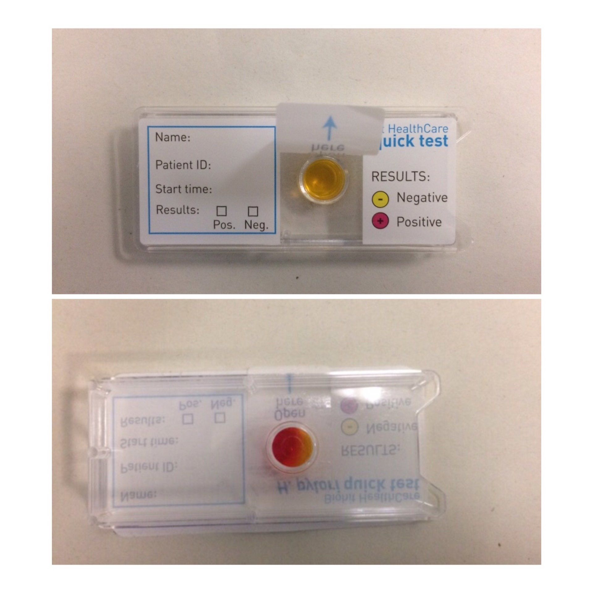 Paediatric Gastroenterology Investigations Helicobacter Pylori CLO test