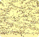 Aluminum
