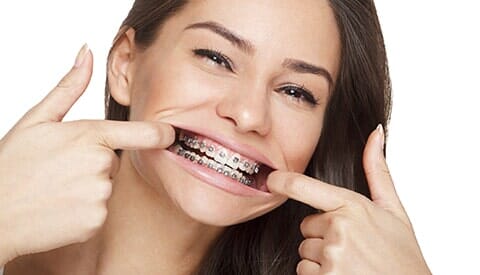 Smile with Braces — Braces in Banning, CA Smile with Braces — Braces in Banning, CA