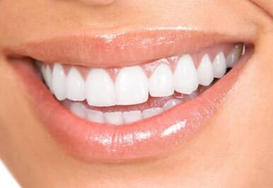 Dra. Jocelyn Vargas Somarriba dientes sanos