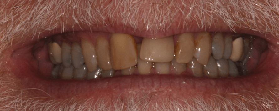 Before