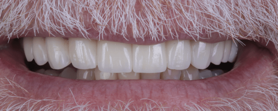 After