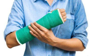 broken arm in a cast