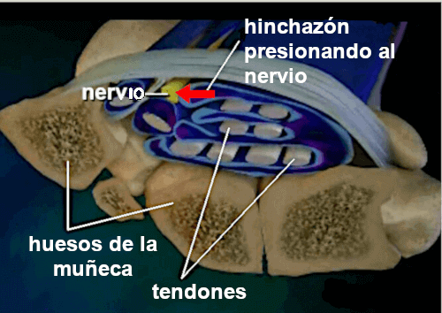 el espacio del túnel carpiano