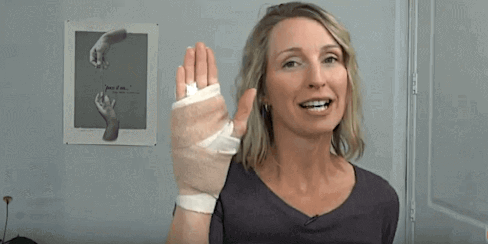 woman with hand bandaged