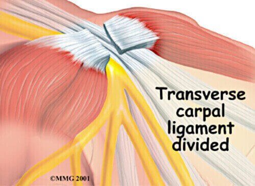 the carpal ligament