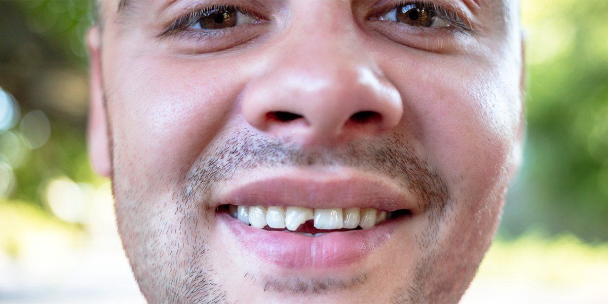 Close-up of a man smiling with a missing front tooth. He has brown eyes and a mustache.