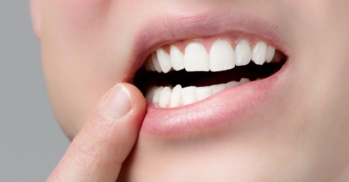 gum disease - periodontal disease