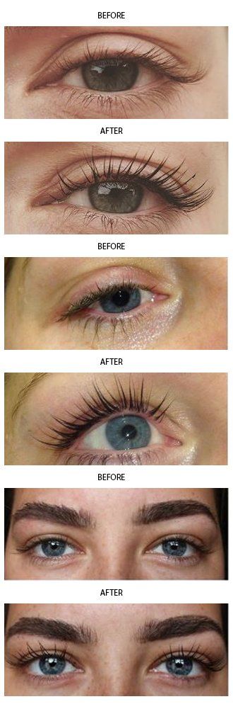 natural lash treatment