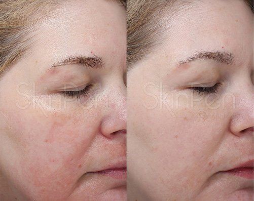 Medical Skin care 3