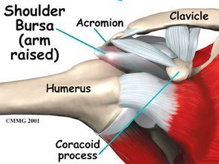 Shoulder Syndromes