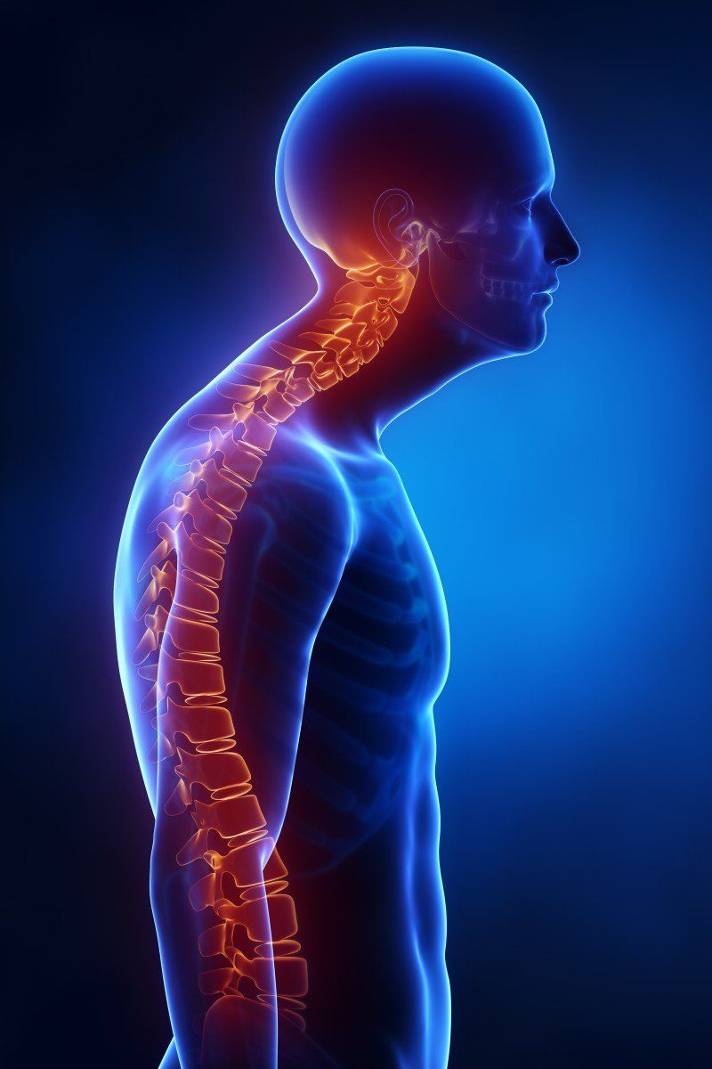 forward head posture