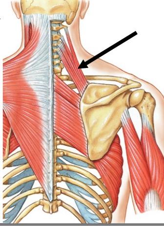 levator scapula sign