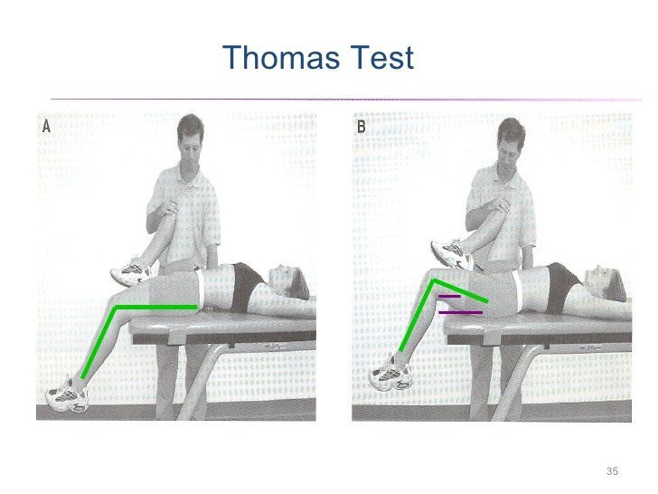 Thomas test