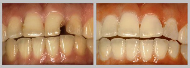 Before/After