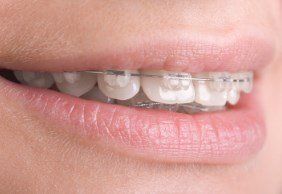 orthodontics las vegas, nv