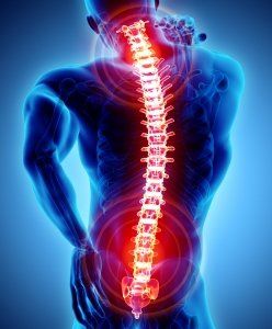 neck and back pain visualization