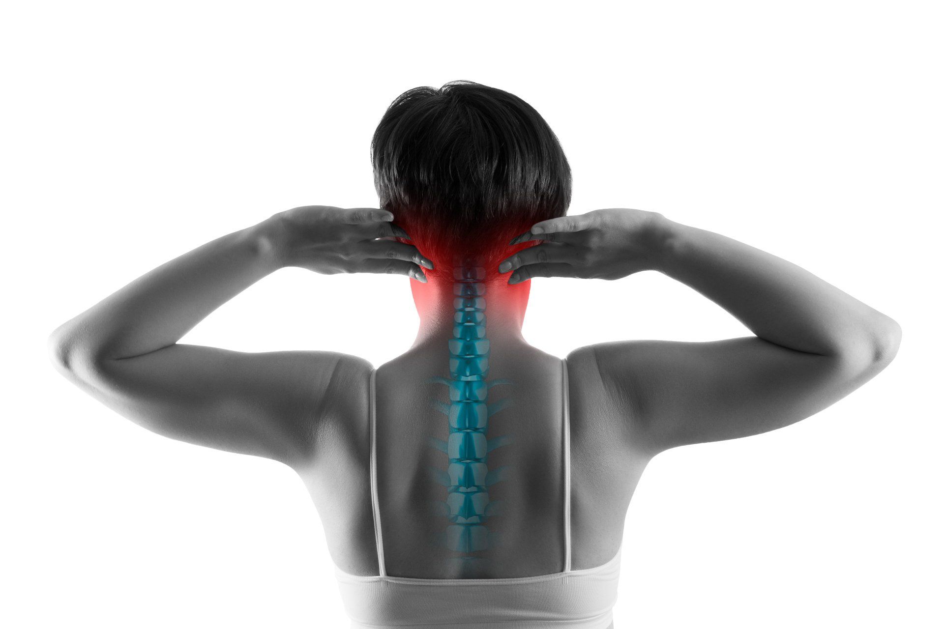 Cervicogenic Headache Image