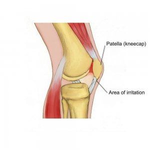 knee drawing