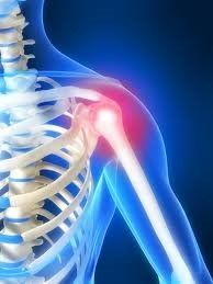 graphic of should pain