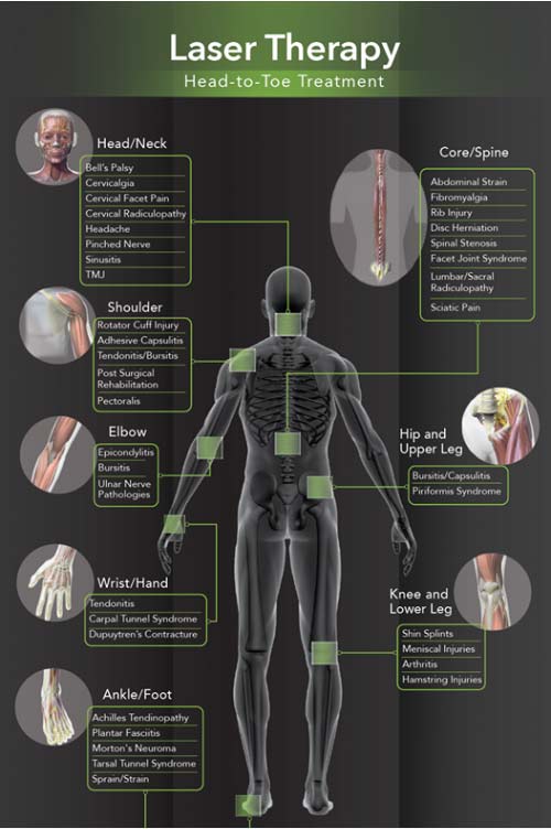 laser therapy