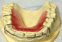 dentures