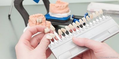 Praxislabor: Ästhetischer Zahnersatz aus einer Hand Praxislabor: Ästhetischer Zahnersatz aus einer Hand
