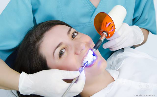 Aktivierung des Bleaching-Gels beim Power-Bleaching. Durch das Licht wird die Bleaching-Wirkung verstärkt.
