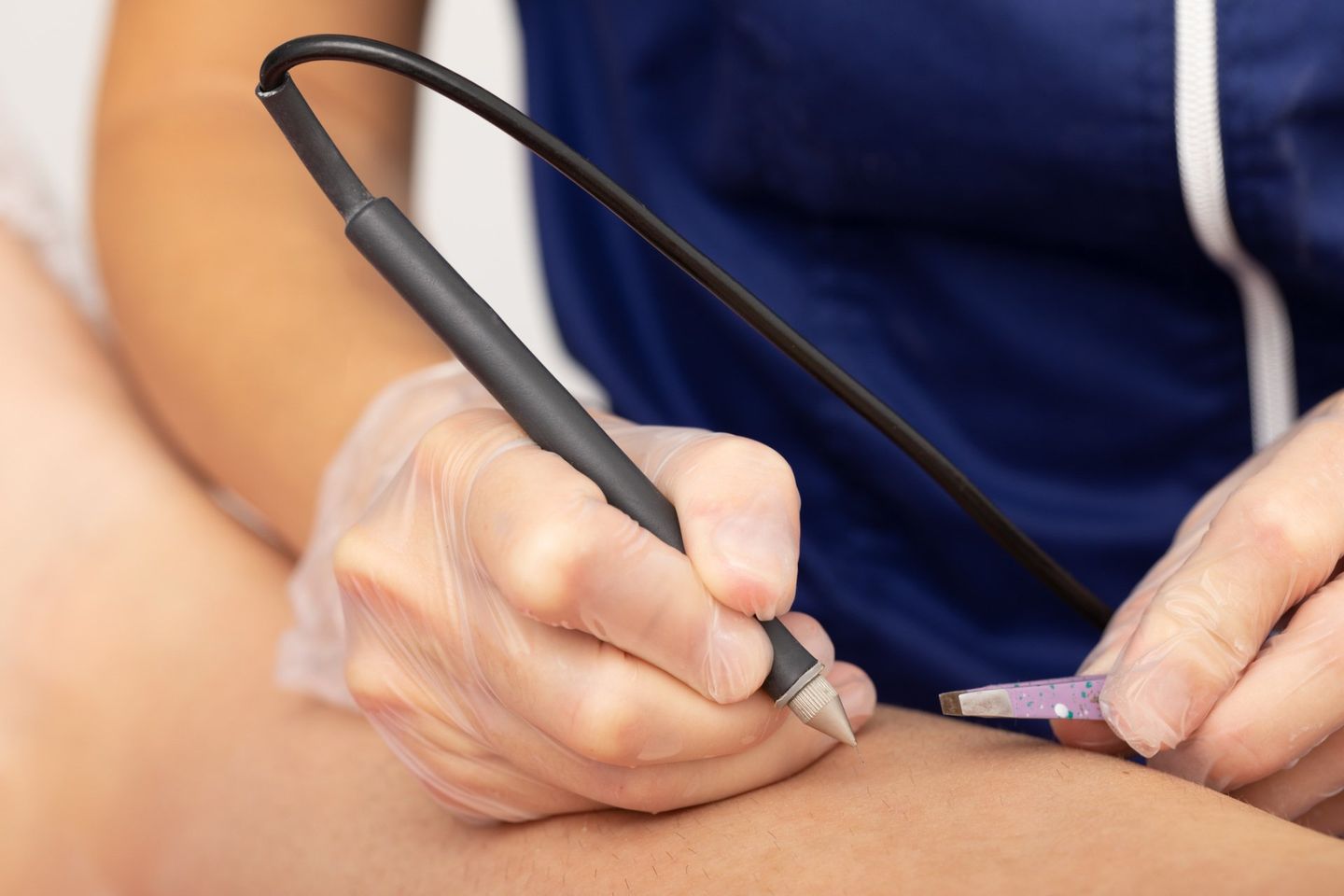 Woman During The Laser Treatment — Duncanville, TX — Duncanville Laser Clinic