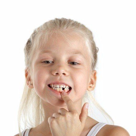 losing a tooth, first tooth lost