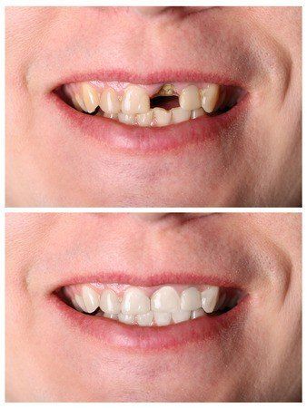 restorative dentistry