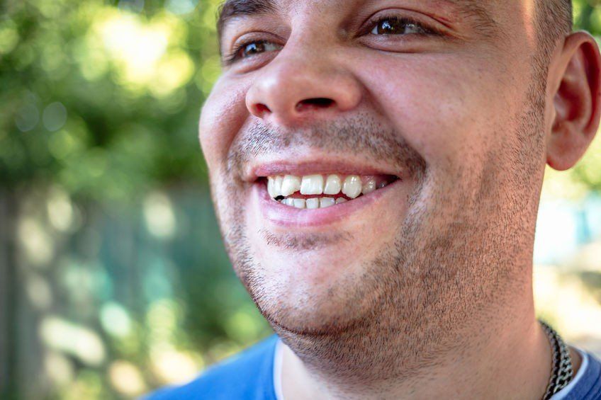 jagged teeth, broken teeth