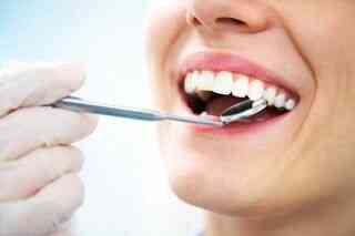 Cavities